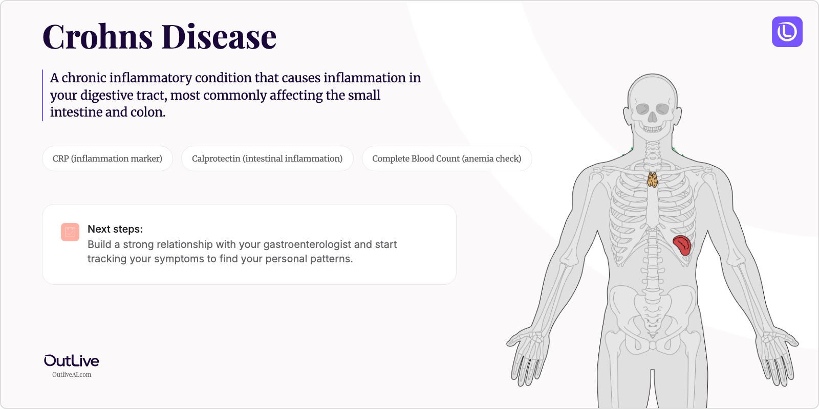 Just Diagnosed with Crohn's Disease: A Simple Guide