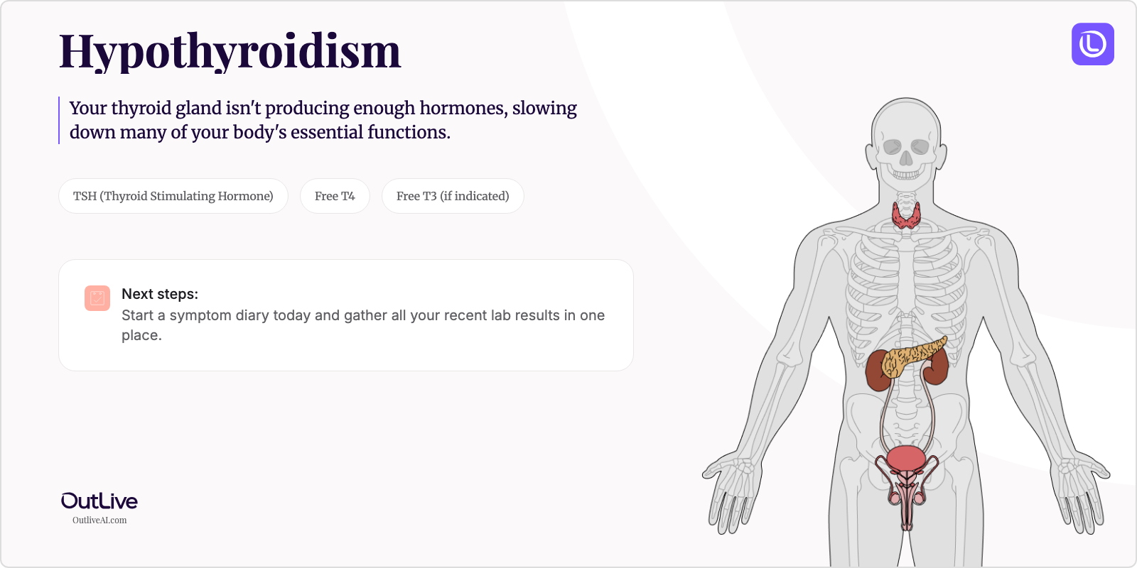 Just Diagnosed with Hypothyroidism: A Simple Guide