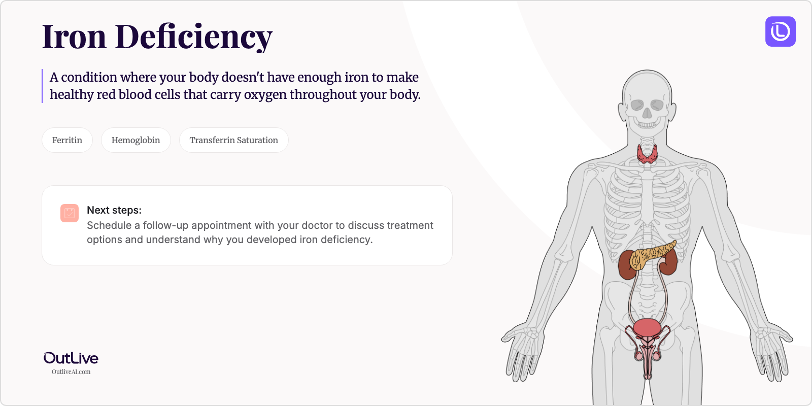 Just Diagnosed with Iron Deficiency: A Simple Guide