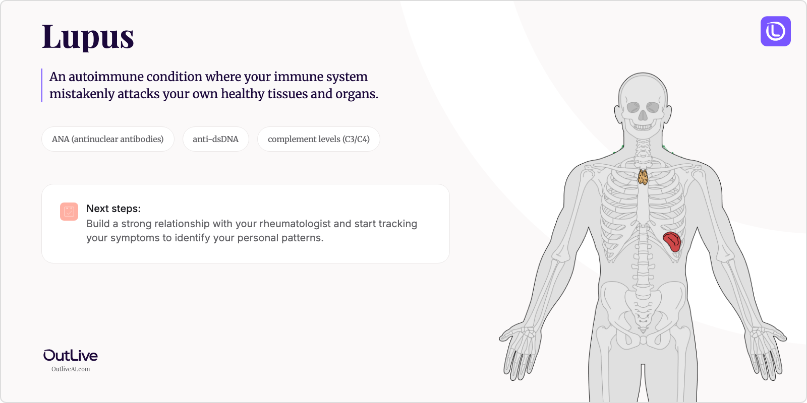 Just Diagnosed with Lupus: A Simple Guide
