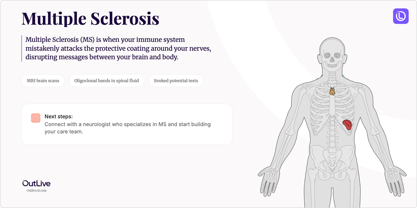 Just Diagnosed with Multiple Sclerosis: A Simple Guide