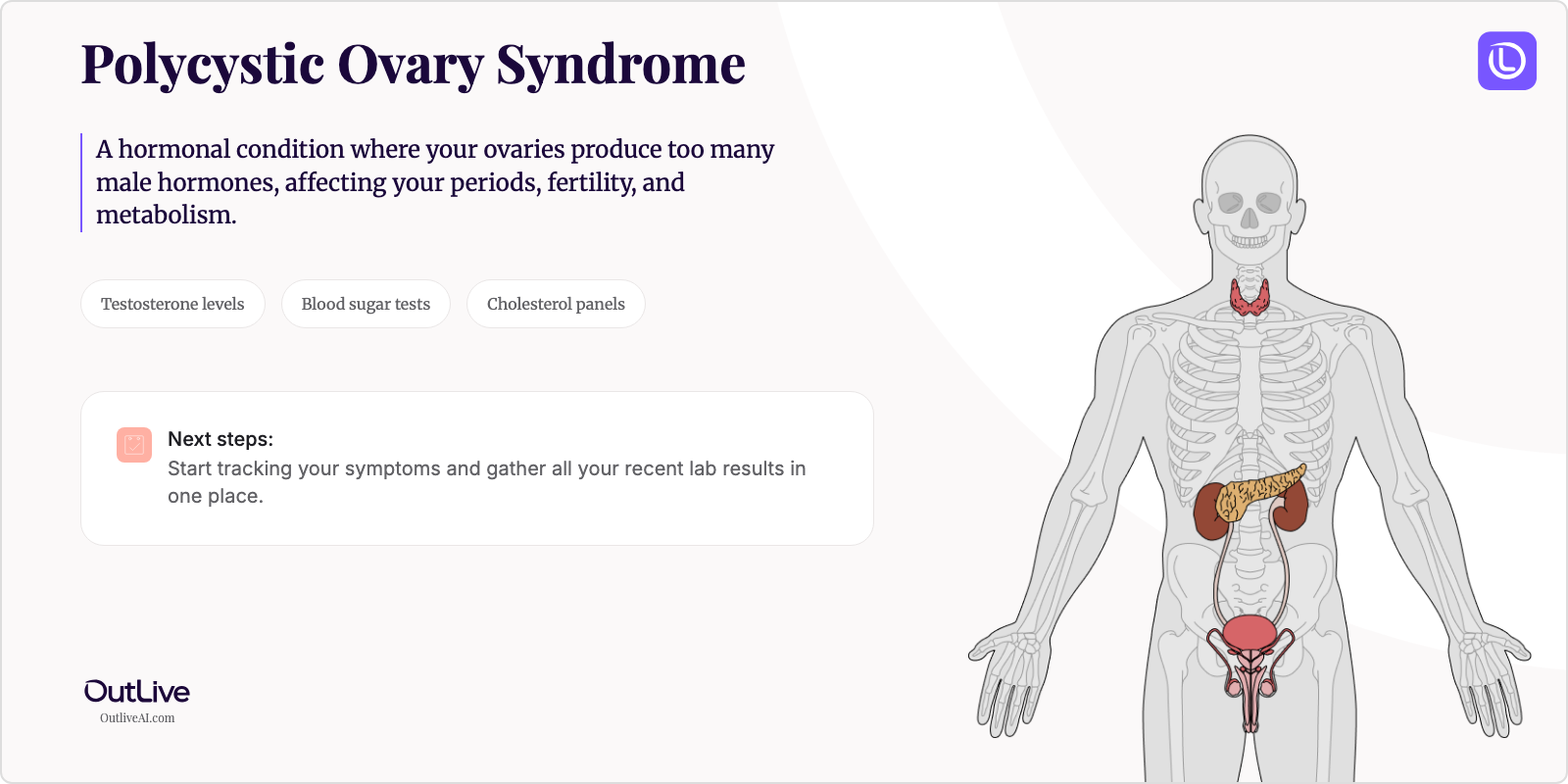 Just Diagnosed with Polycystic Ovary Syndrome: A Simple Guide