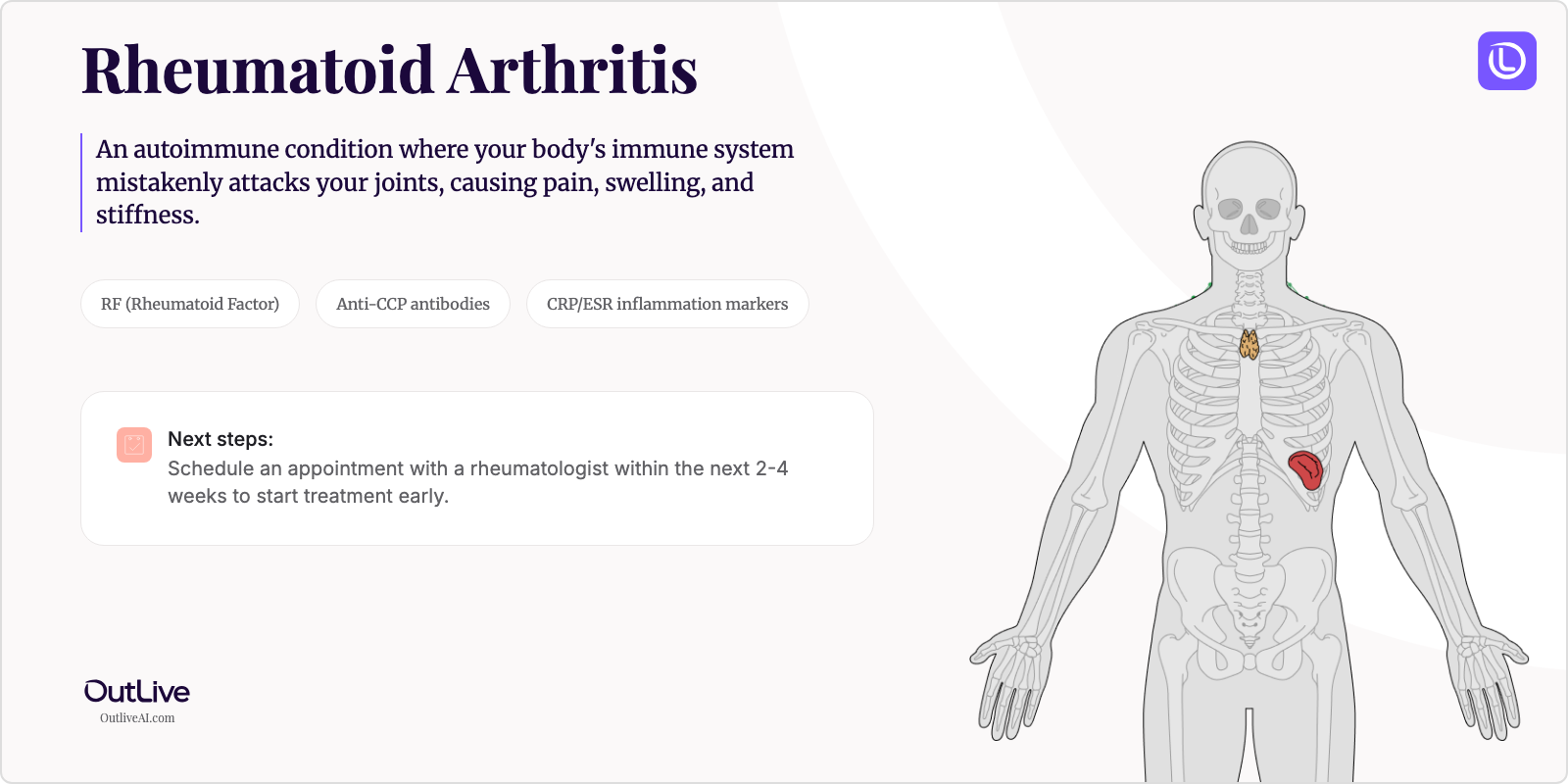 Just Diagnosed with Rheumatoid Arthritis: A Simple Guide