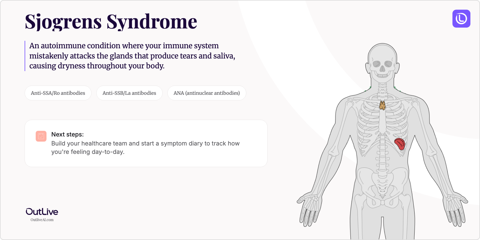 Just Diagnosed with Sjögren's Syndrome: A Simple Guide
